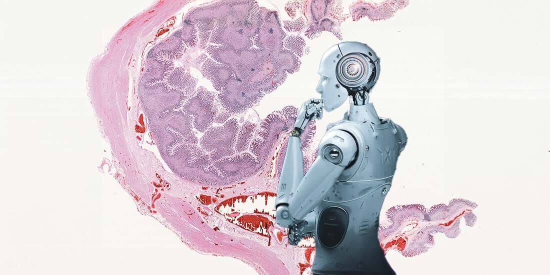 Can AI Read Your Pathology Slides Better Than Humans?
