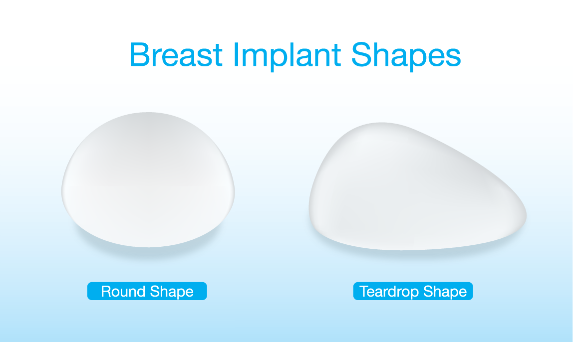 New breast implant materials