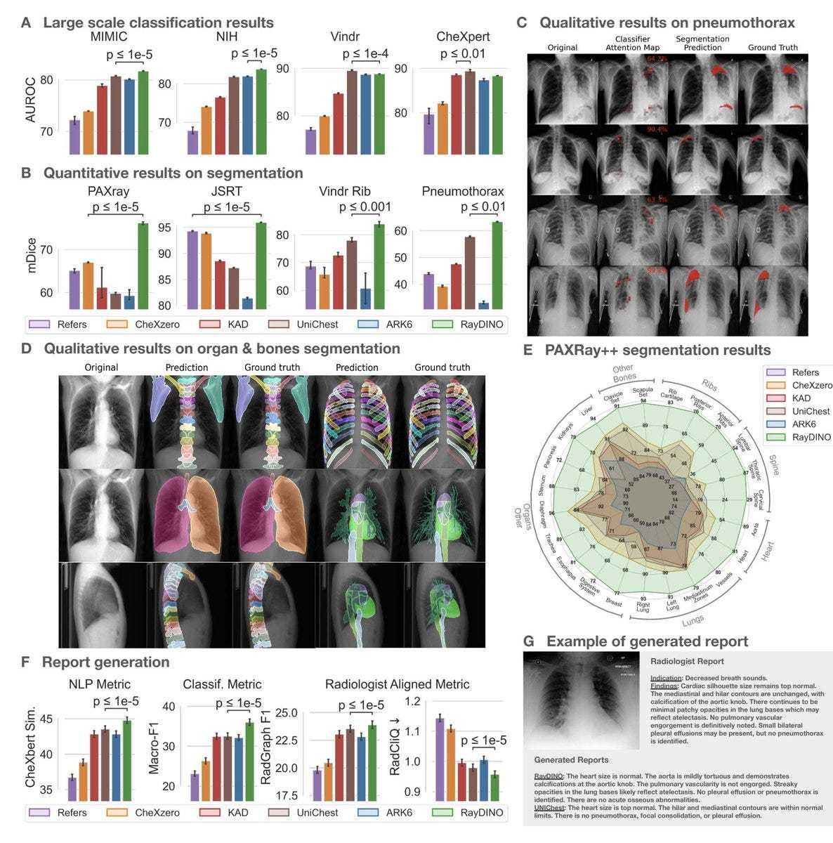 RayDINO: A visual model capable of comprehensively analyzing chest radiographs and identifying…