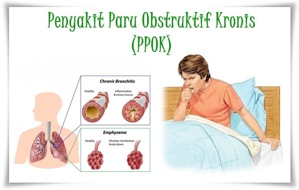 Hasil gambar untuk ppok adalah