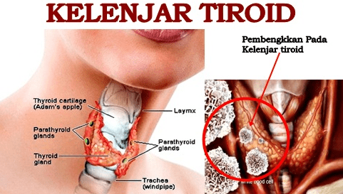 Penyakit Tiroid - Blog Kesehatan Anda