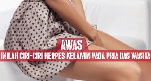 Obat Herpes Genital Wanita Obati Penyakit Herpes Medium