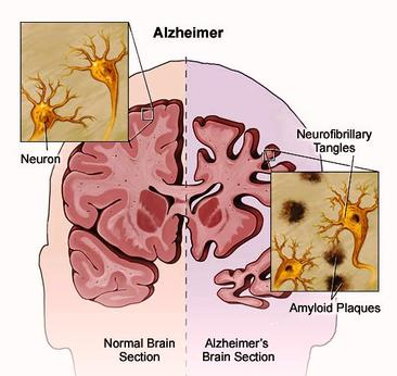 The Memory Keepers: Understanding the Communication breakdown in ...