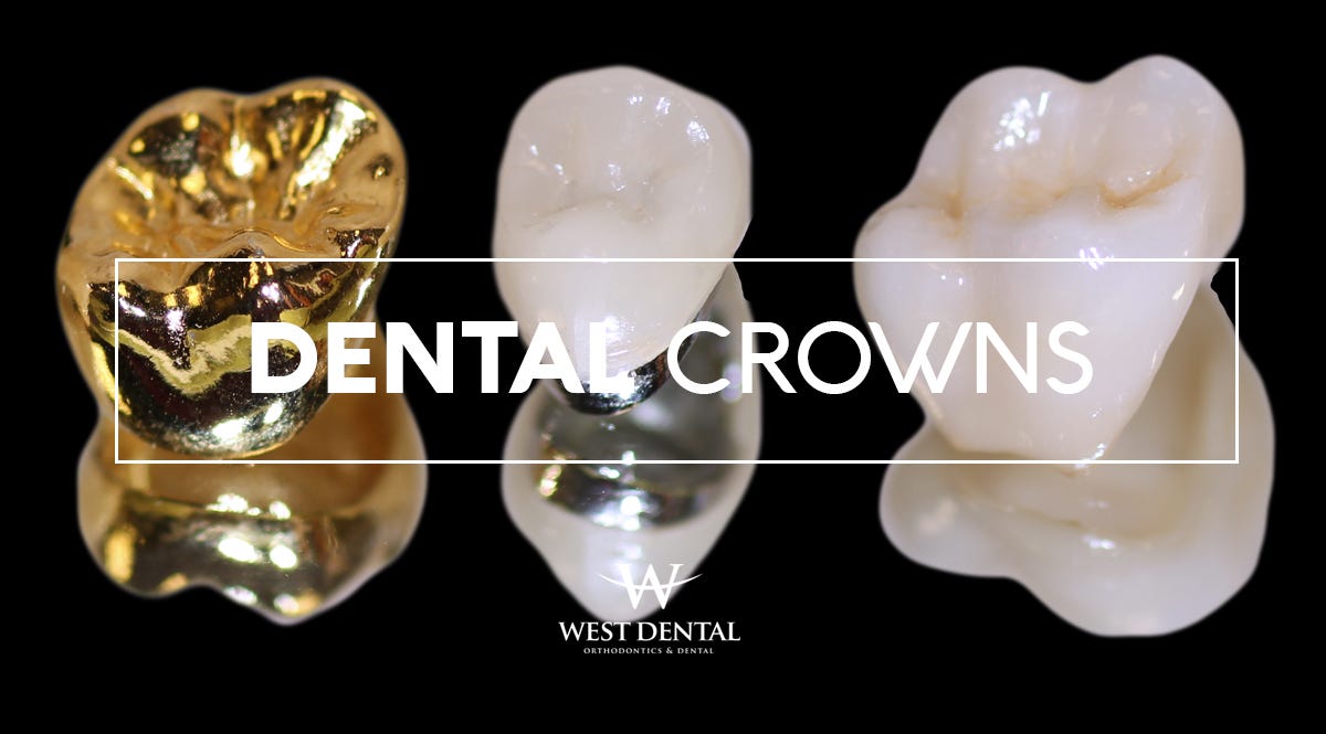 Types and benefits of Dental Crowns West Dental Medium