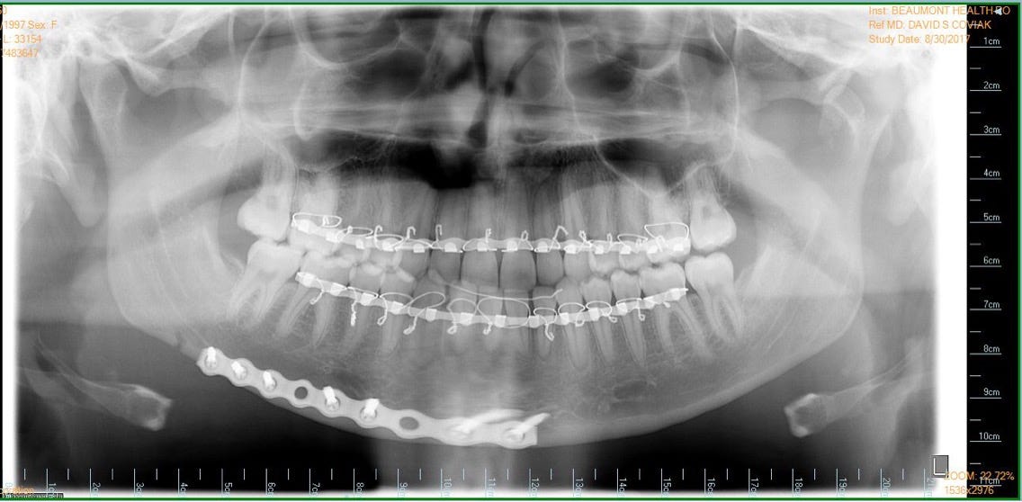 How to Un-Break Your Jaw – Claire Nord – Medium