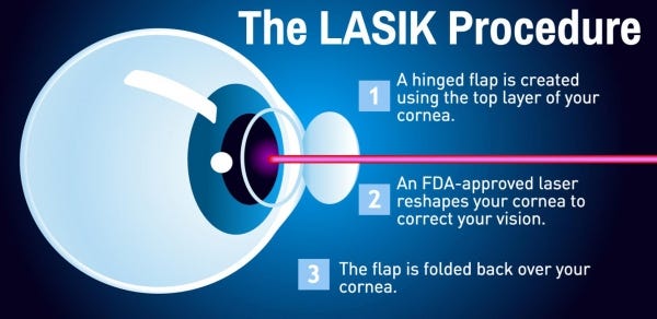 Precautions to be taken before and after Lasik Eye surgery