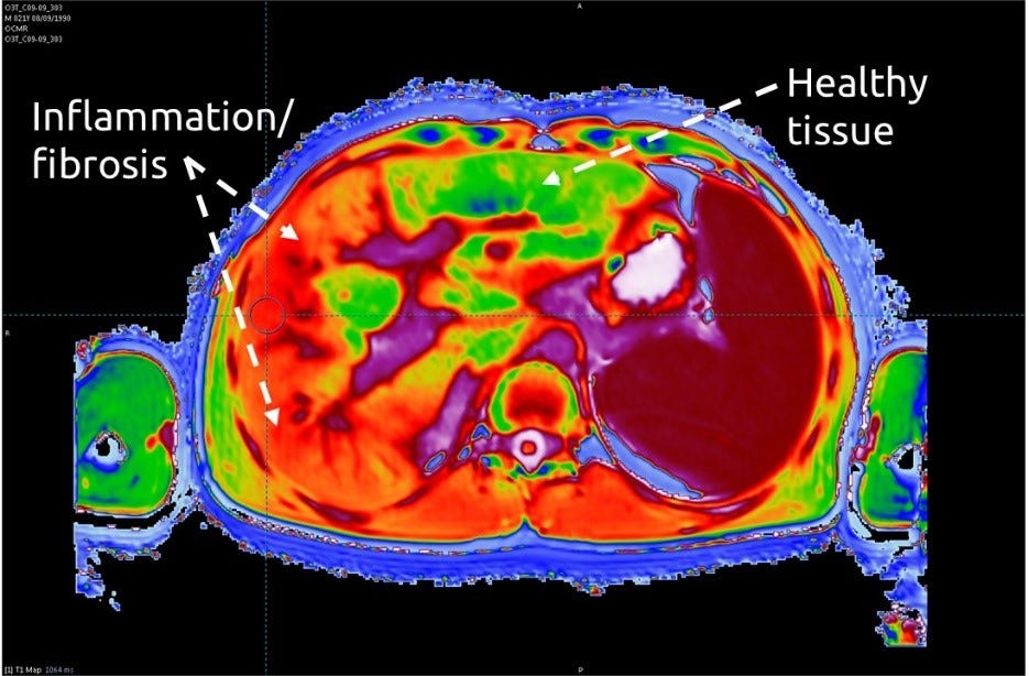 multiparametric-magnetic-resonance-imaging-mri-as-a-safe-non