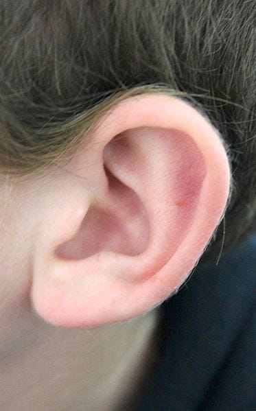 How to Clear Your Plugged (Blocked) Ears! – #HealthHacks — Home