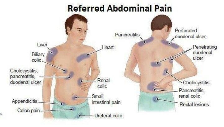 Take The Stress Out Of colic abdomen pain treatment gall stone pain diagram 