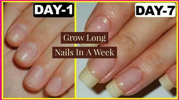 Latest stories published on How To Get Long Nails In One Week In 2019 –  Medium