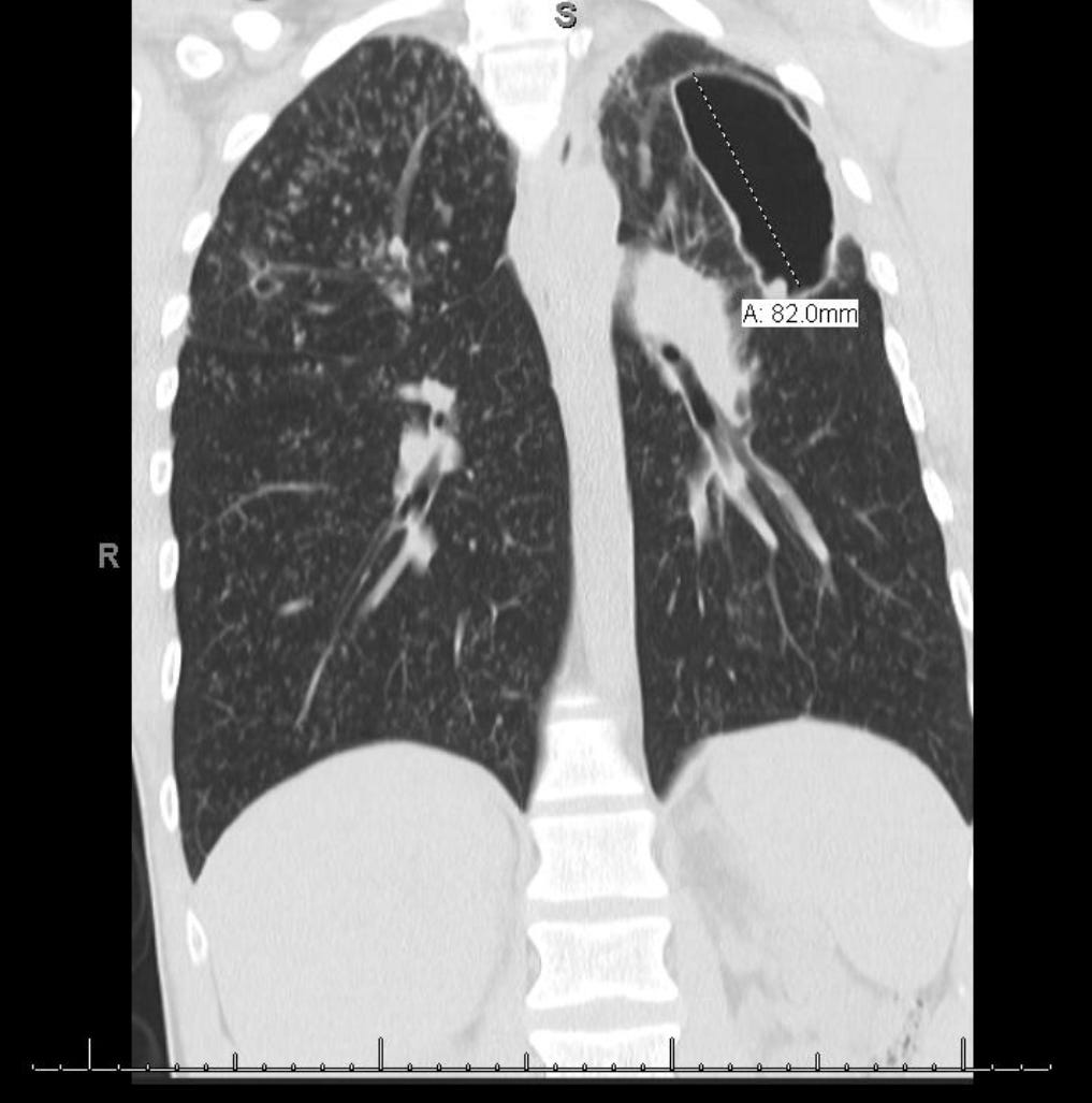 The deadly epidemic you’ve never heard of Substance