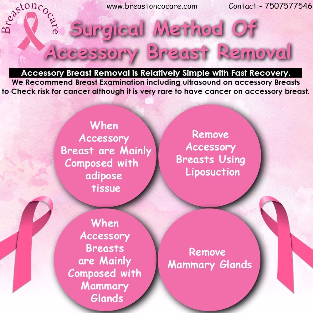 SURGICAL METHOD OF ACCESSORY BREAST REMOVAL Dr. Neemesh Lodh Medium