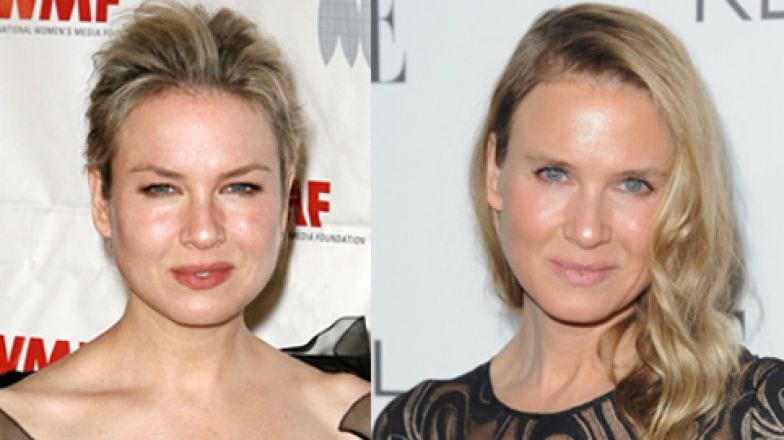 Feature Shock: Renee Zellweger and the Face of Morphological Freedom