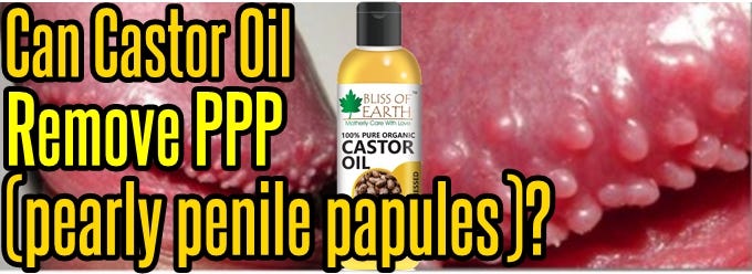 Can castor oil remove PPP (Pearly penile papules)? 
