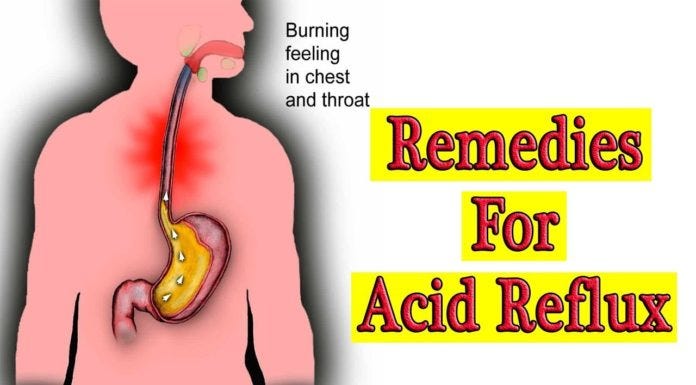 How To Stop Acid Reflux | How To Treat Acid Reflux (2019)