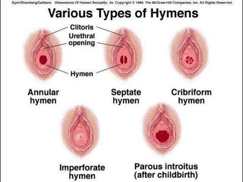 That vagina and virginity Share vagina and virginity have removed
