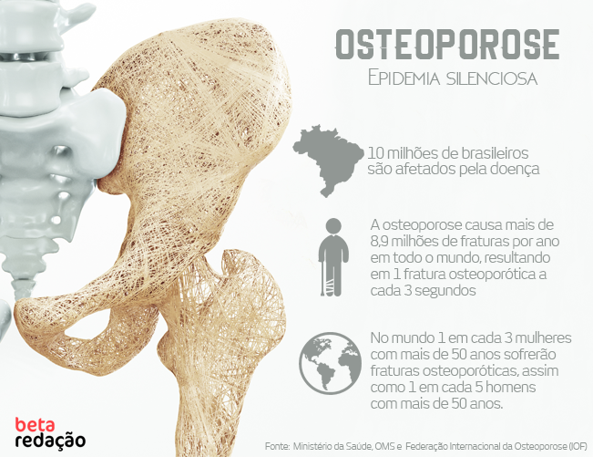 Fator Que Favorece O Surgimento Da Osteoporose