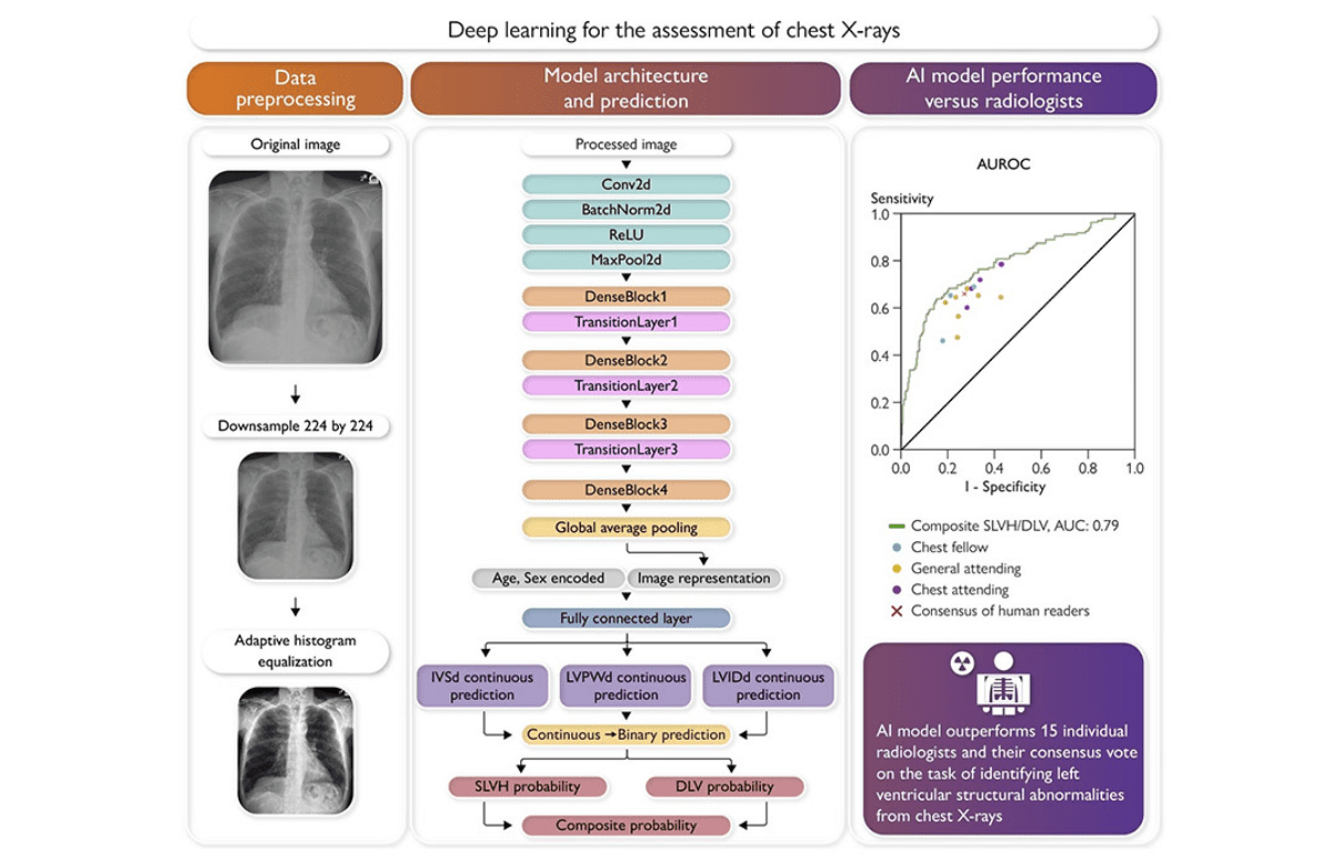 Revolutionizing Heart Failure Diagnosis:AI Outperformed Radiologists on Chest X-Rays