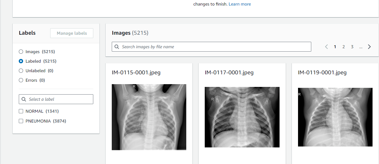 How AI and AWS Rekognition Could Revolutionize Healthcare Diagnostics