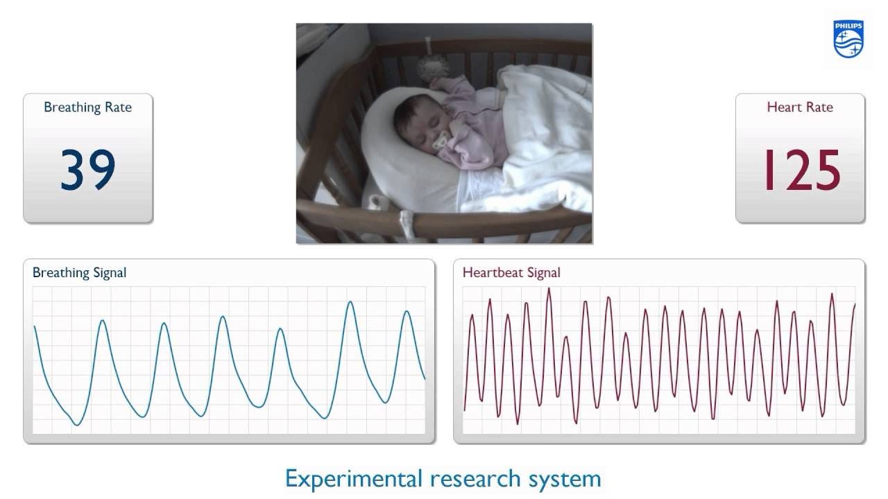 AI Contactless Heart Rate Detection: Enhancing Healthcare with Eulerian Magnification