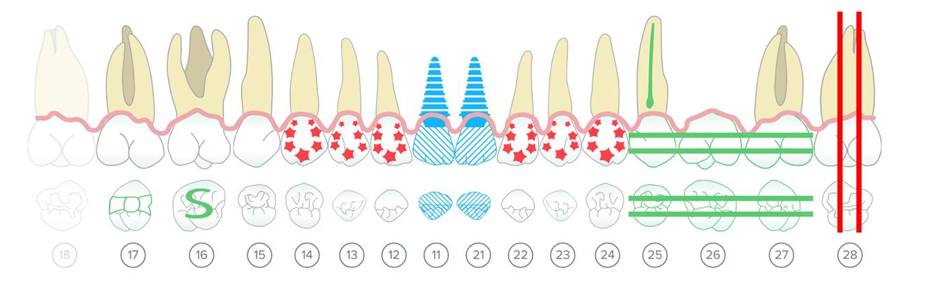 Copyright Protection Story: Dentaltap VS. Dentolize Inc.