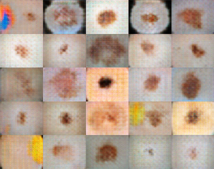Figure D. Synthetic medical image generation using GAN (source)