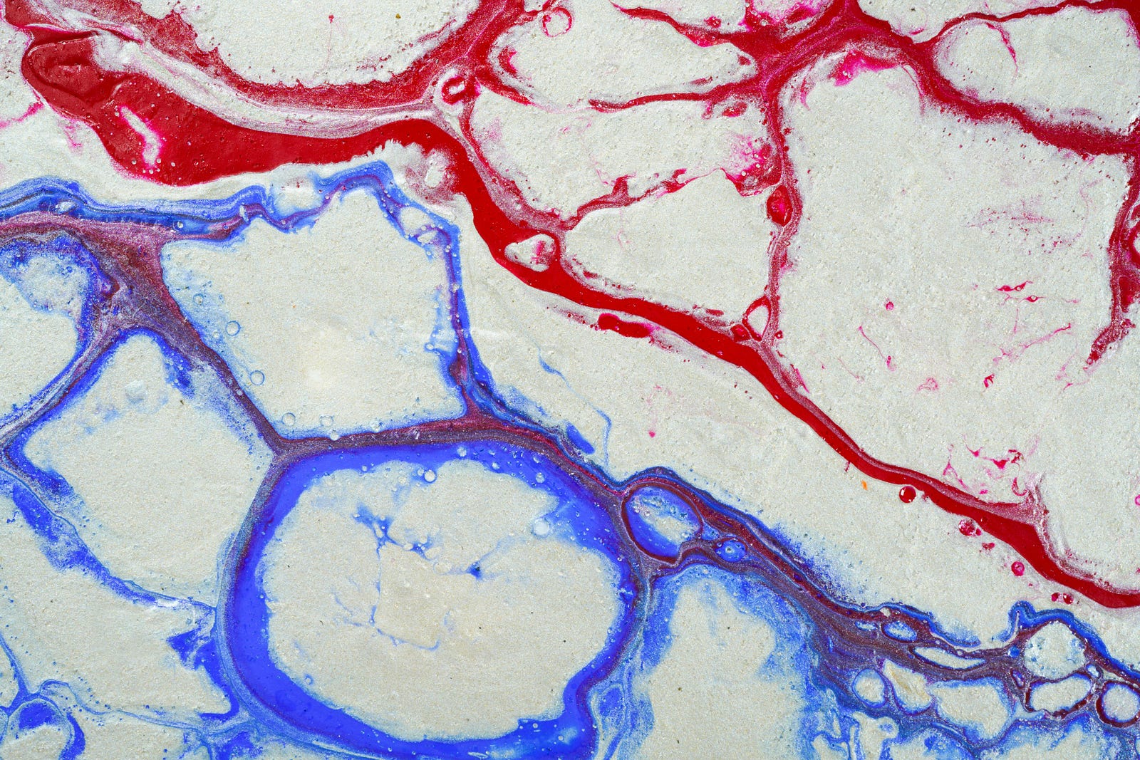 Blood vessels (arteries and veins), as visualized microscopically. Alzheimer’s Society explains that high blood pressure inflicts damage on the brain in several ways, often starting with arteriosclerosis.