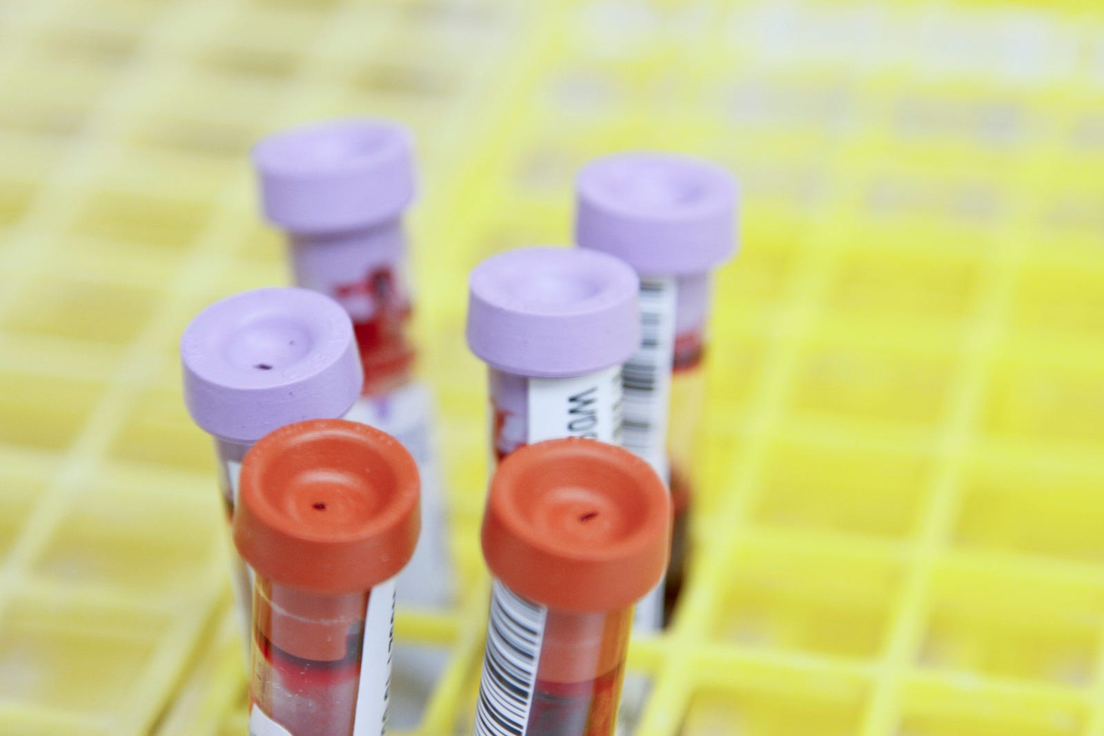 Six tubes of blood, including four purple tops and two red ones.