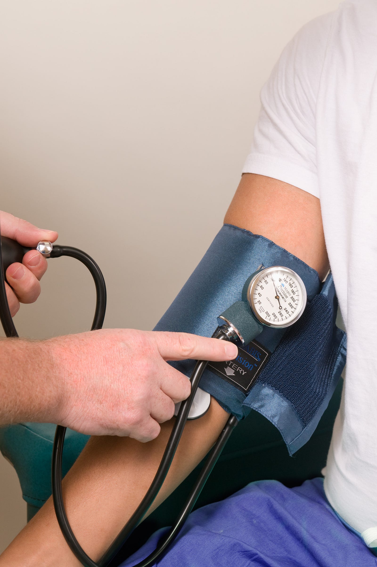 Close-up of an arm with a blood pressuring measuring cuff on it. High blood pressure is widespread, with estimates suggesting that approximately one in three adults worldwide suffers from high blood pressure.