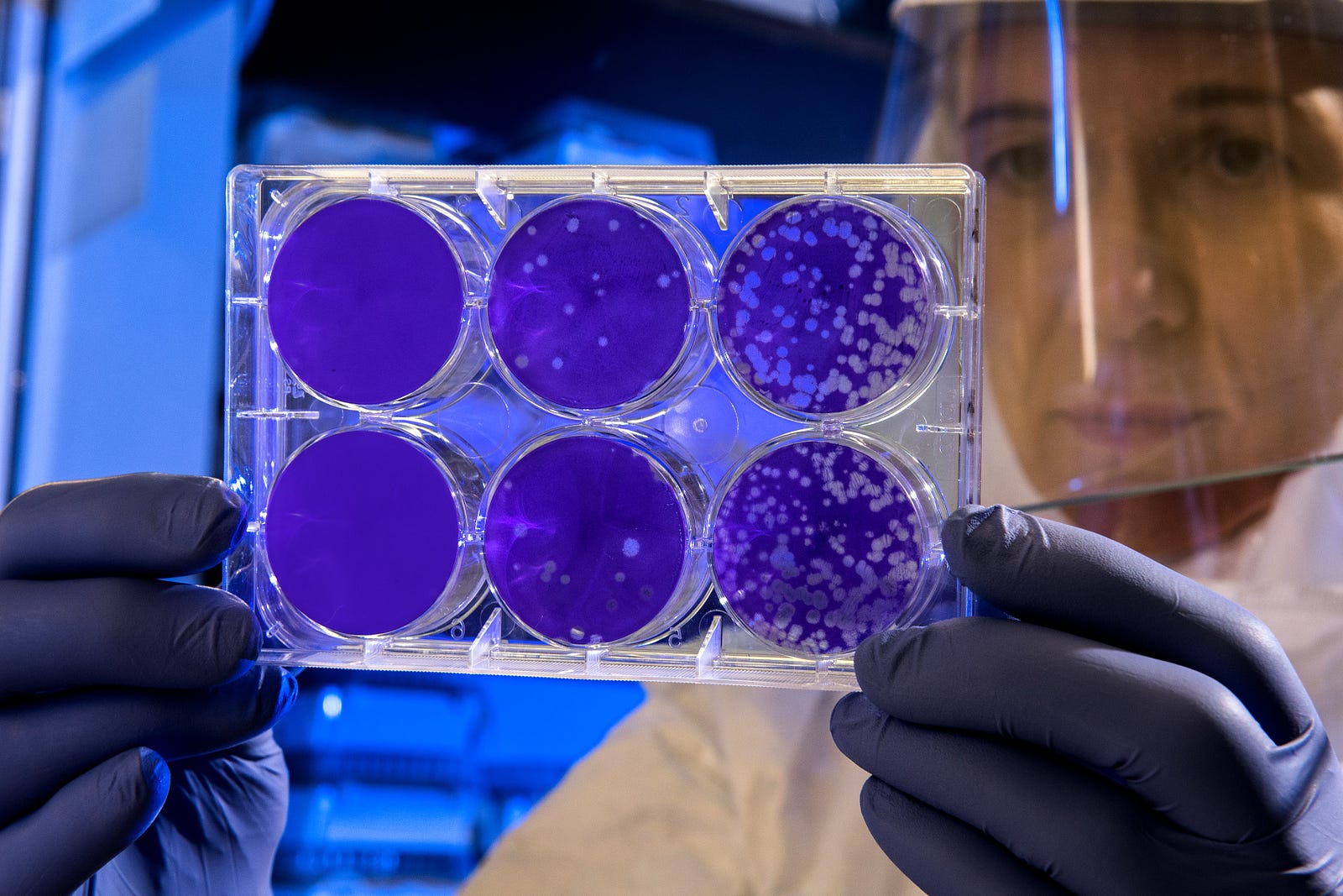 A scientists peer at a tray of six petri dishes. The media are purple, with microbial colonies white. Since shopping carts are often left outside, the researchers considered how the local climate might affect bacteria survival. For example, factors like humidity and temperature can impact bacteria on surfaces. They focused on the cart handle and seat, swabbing them with a SpongeStick containing a neutralizing buffer.