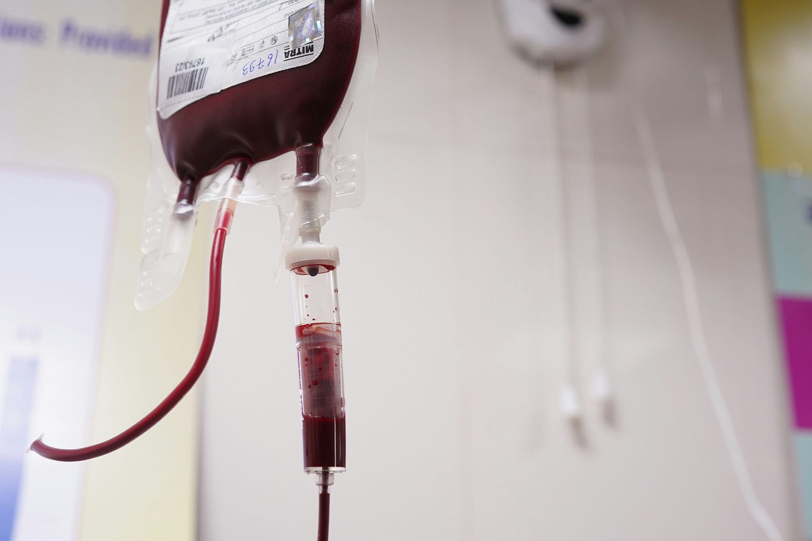 A blood tranfusion. Anti-aging entrepreneur Bryan Johnson admits that he will not repeat the infusions, given no discernable benefits from the practice.