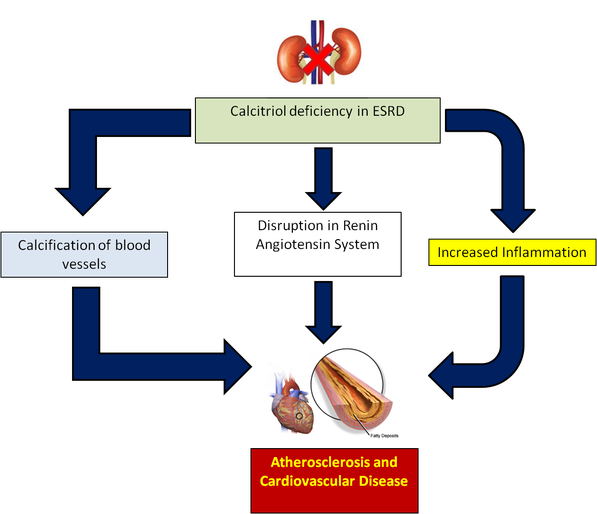 THE VITAMIN D CRISIS IN ENDSTAGE RENAL DISEASE Nutrisphere Medium