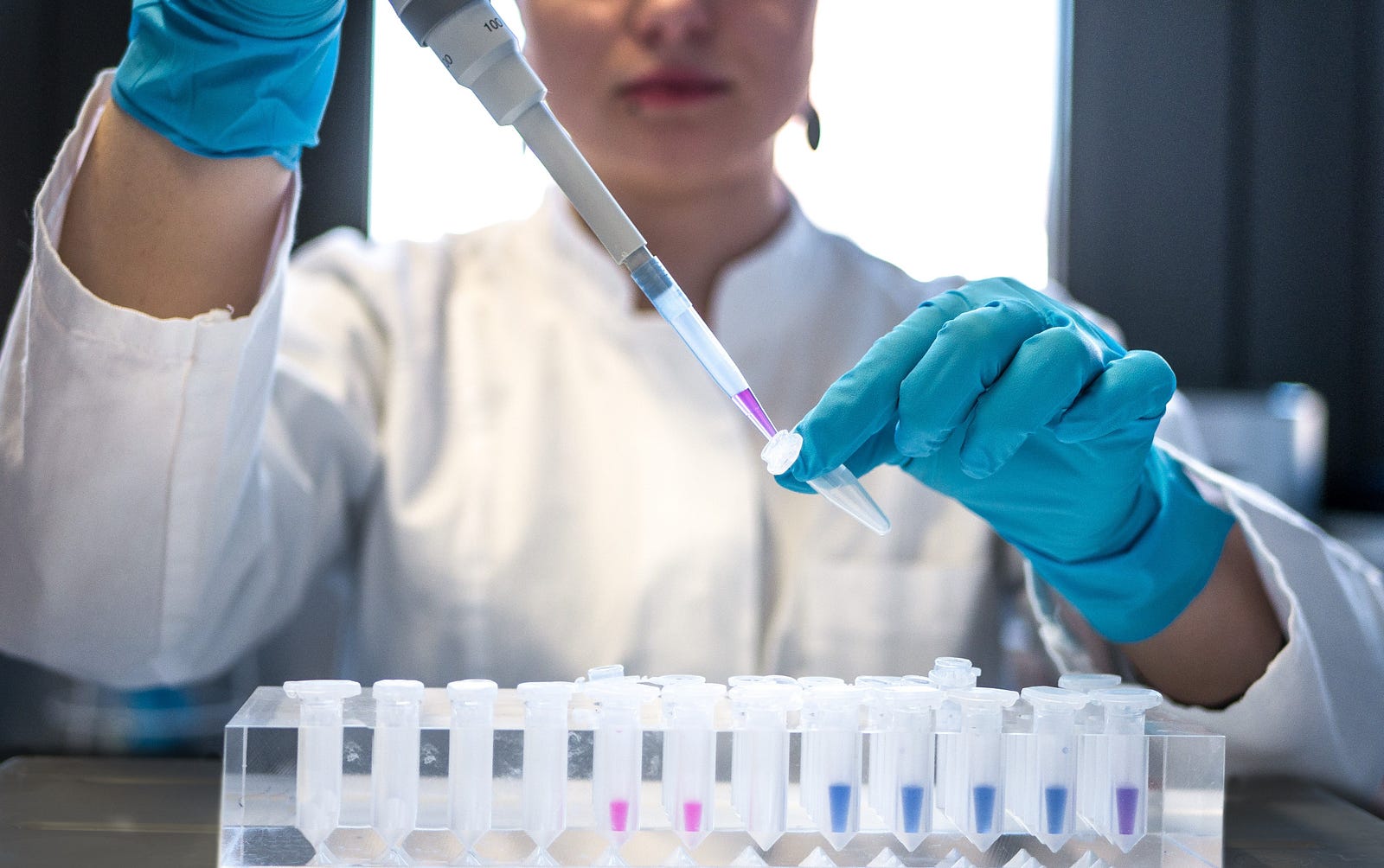 A lab worker uses a pipette to place fluid into a test tube. Saliva, often dismissed as a mere bodily fluid, is taking center stage in cancer diagnosis.