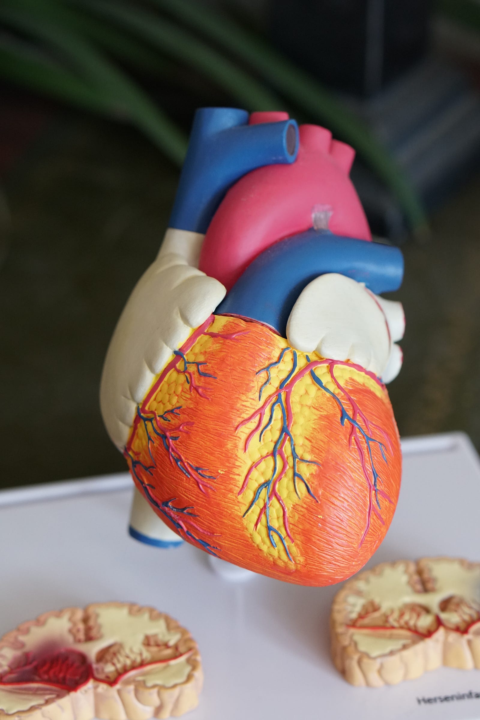 Anatomical model of a heart. Atrial fibrillation is associated with a higher risk of dementia, according to a new University of Washington (USA) study.