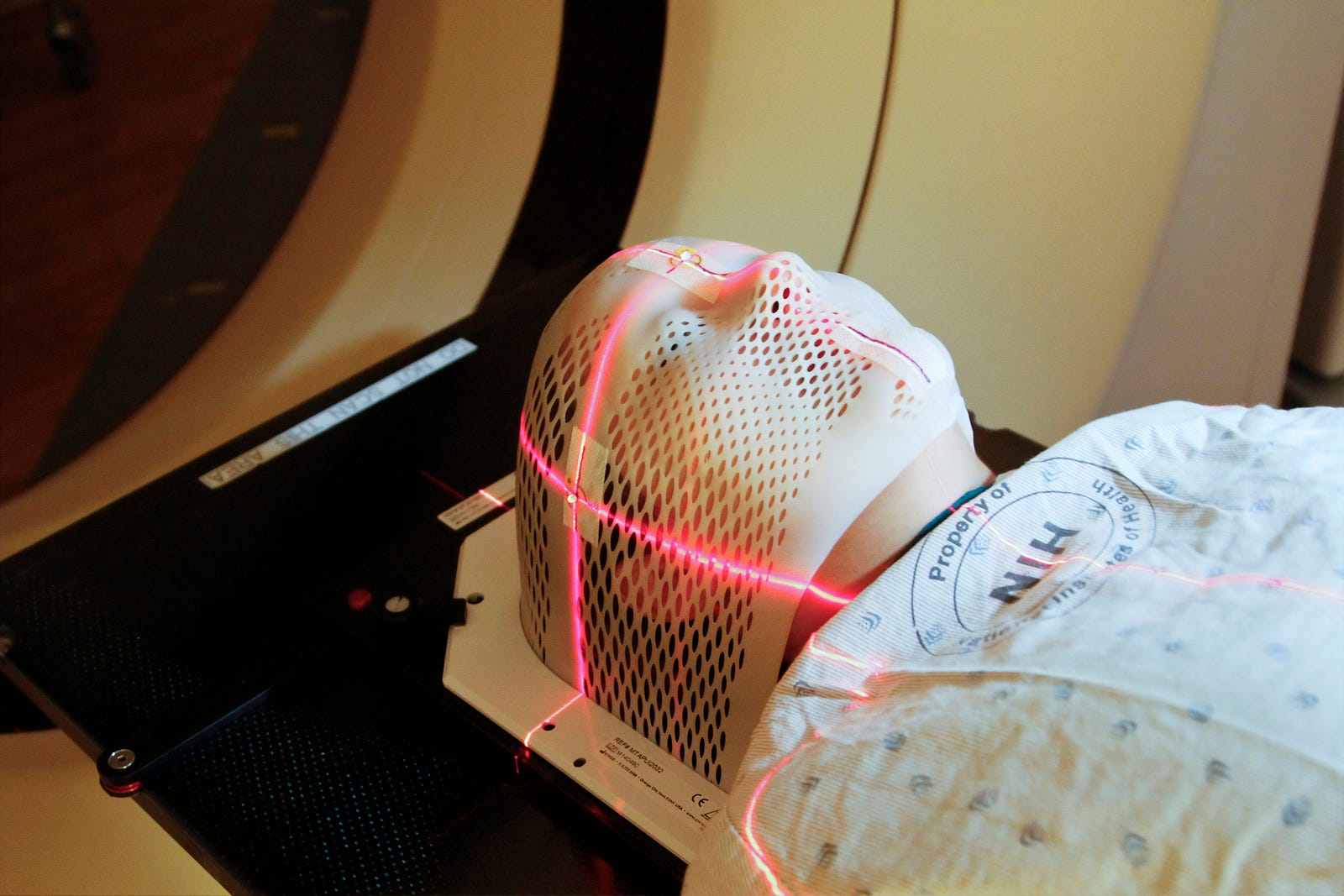 A person lies with in a head immobilization device, awaiting treatment for their primary brain tumor.