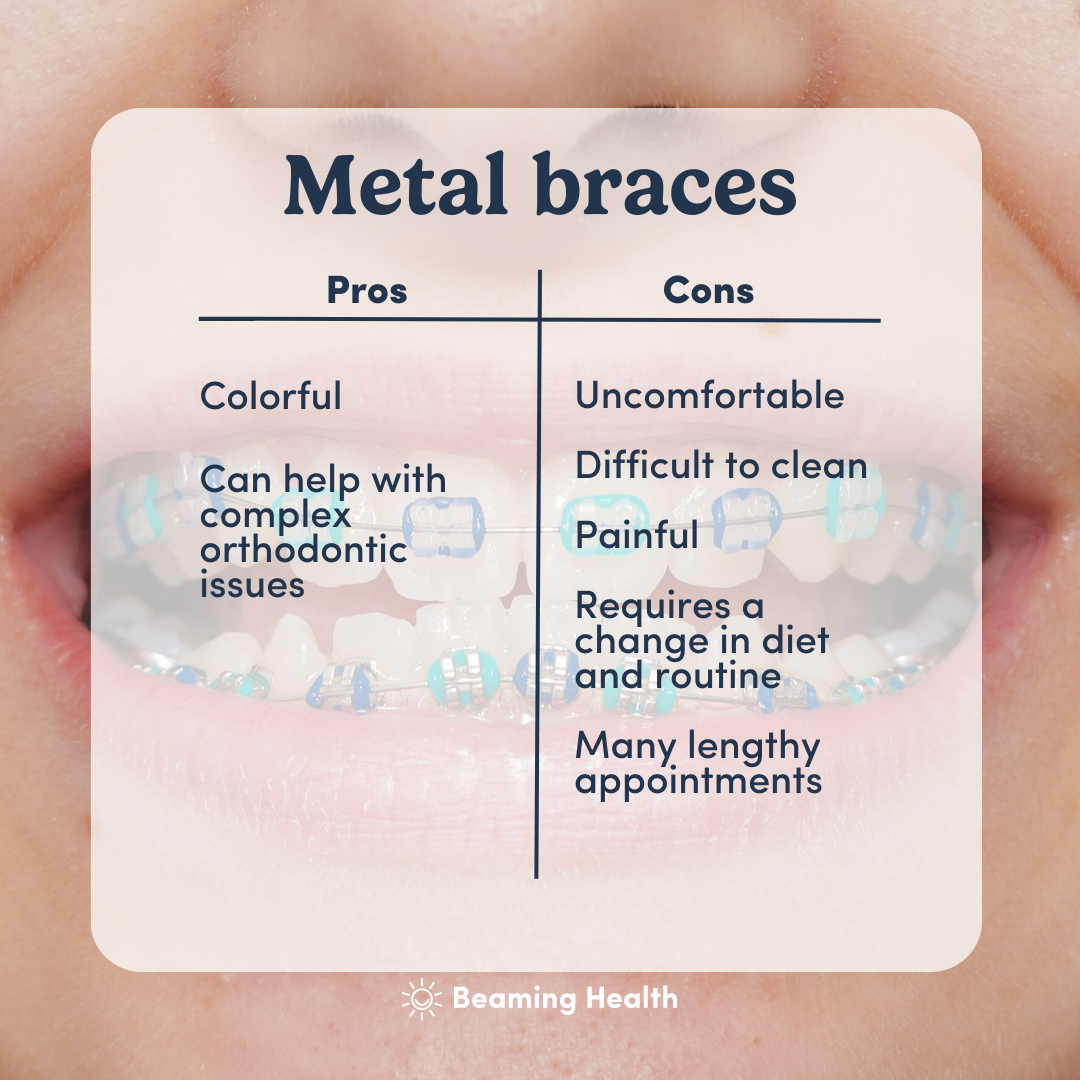 A Guide To Preparing Your Child For Braces Or Invisalign Treatment, by  miamiorthodontist group