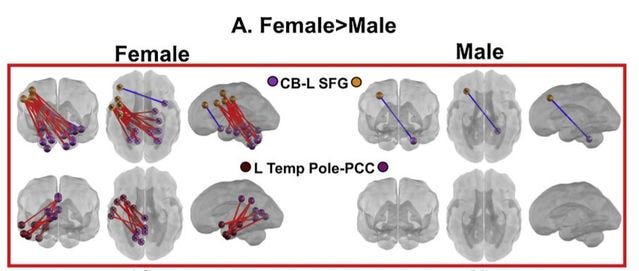Neurociencia: No hay un cerebro masculino y otro femenino. 0*drShgzfnZDIdfK76