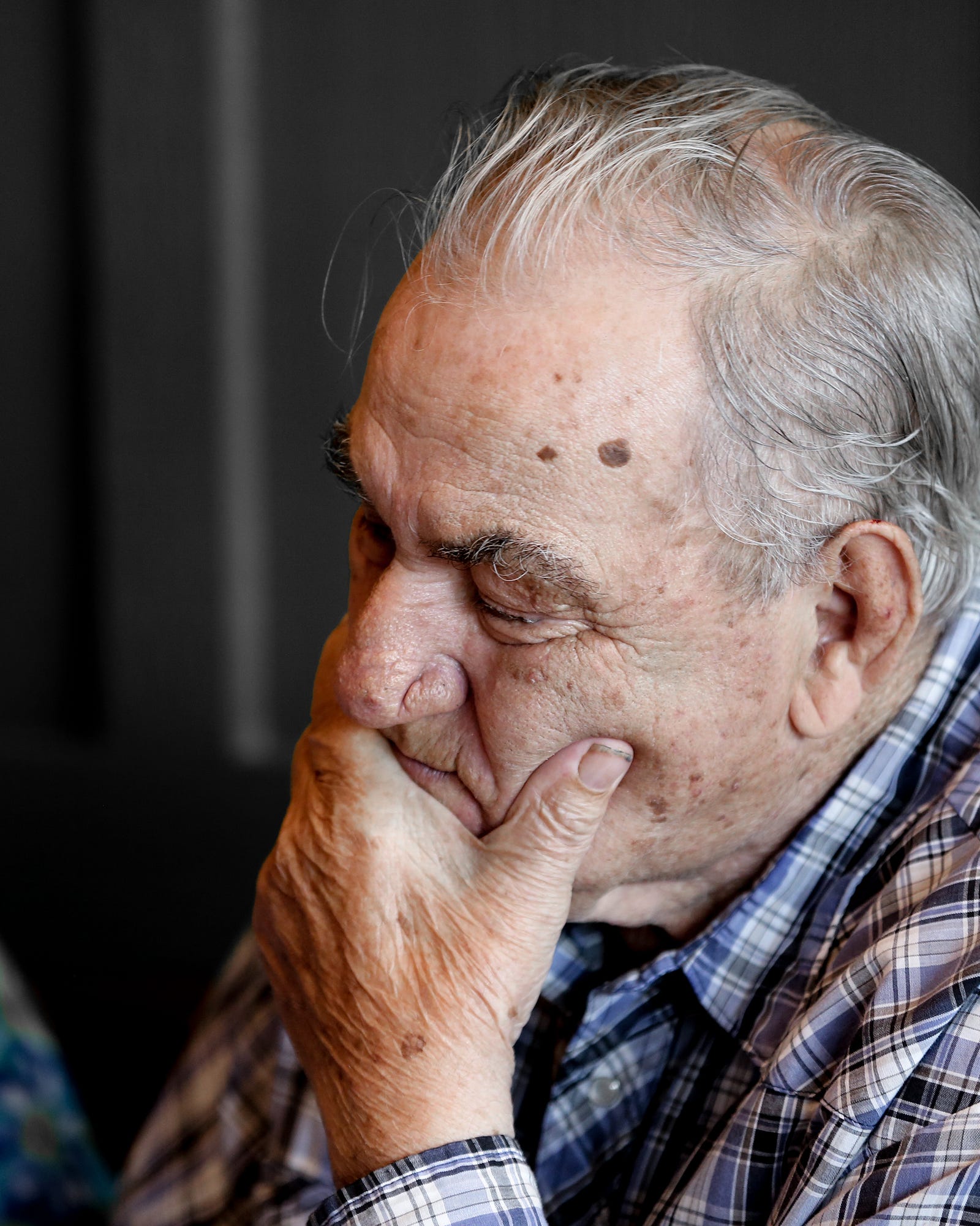 An elderly white man faces left, eyes closed as he grasps his loewr face with his left hand. Diet appears to influence the risk of dementia, including Alzheimer’s disease.