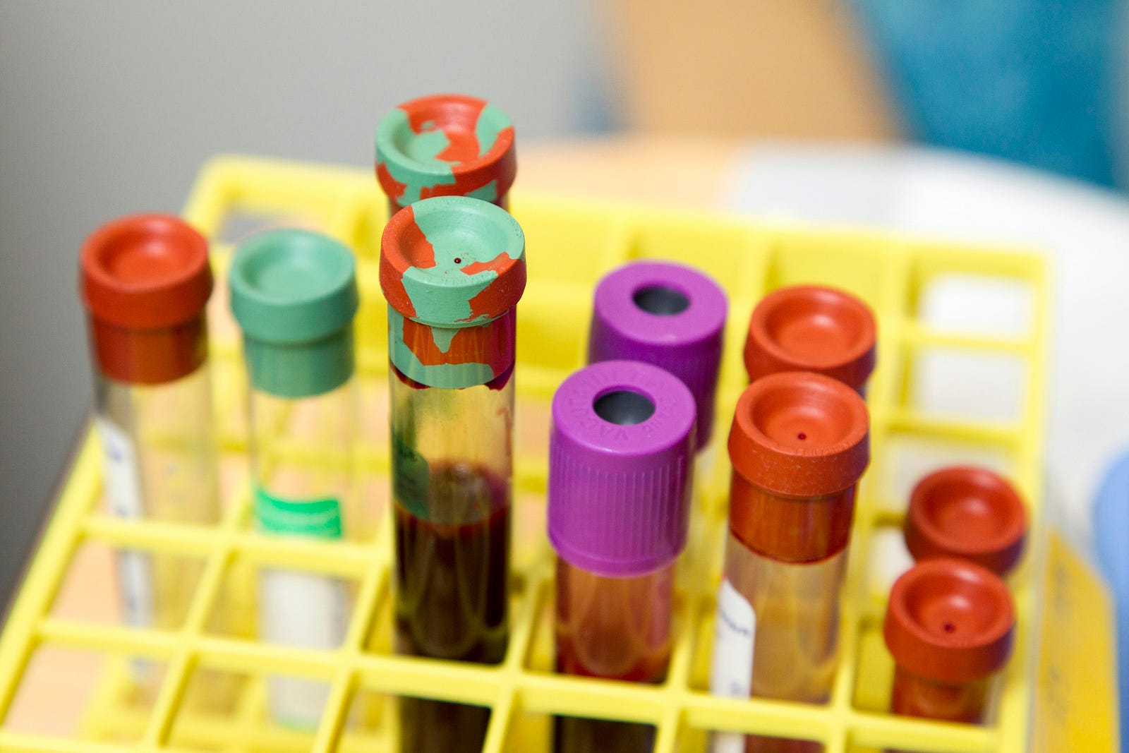 Vials of blood to test changes induced by various diets.