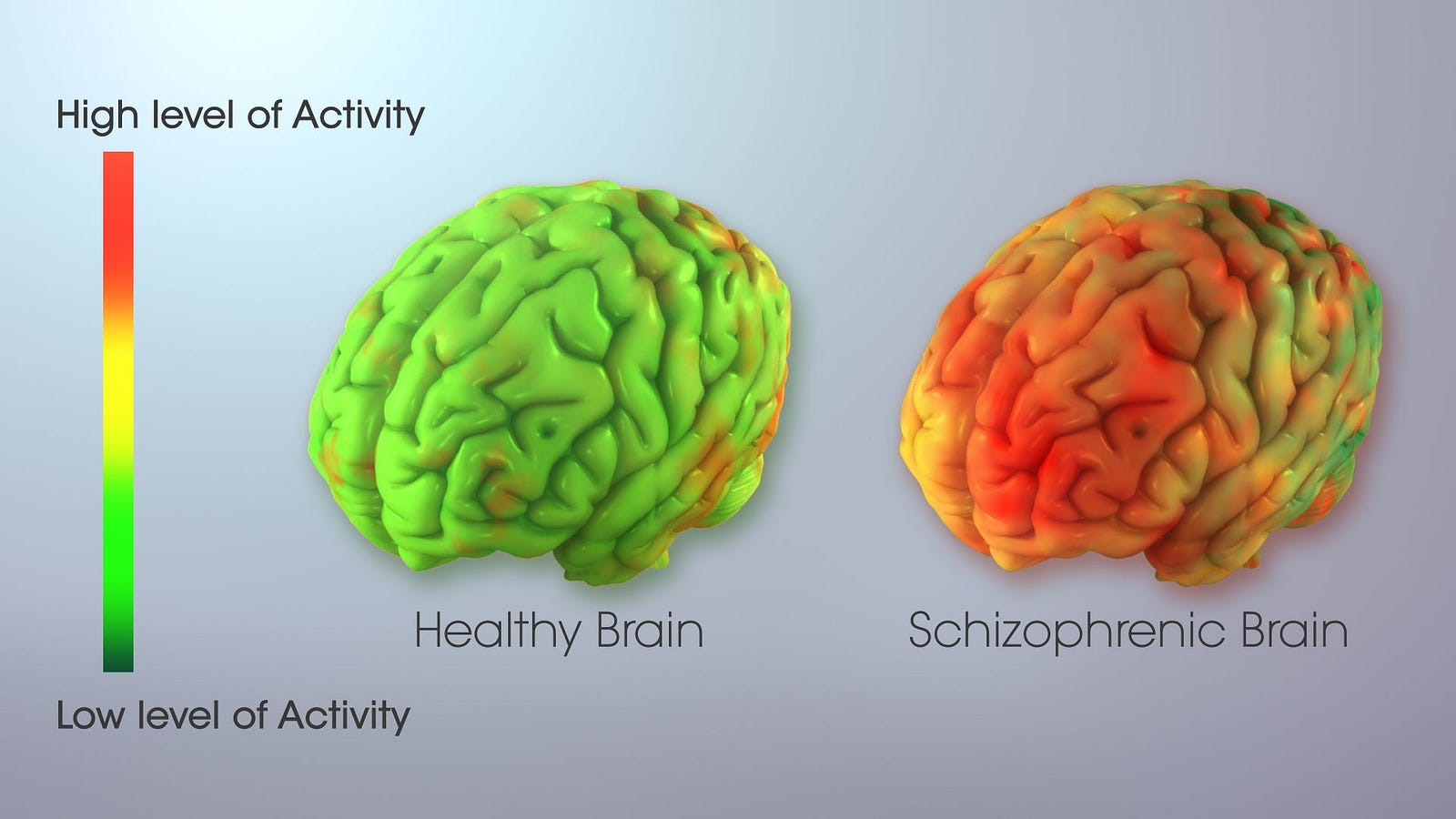 Schizophrenia And Bipolar Disorder: The Overlap – ScientificAnimations ...