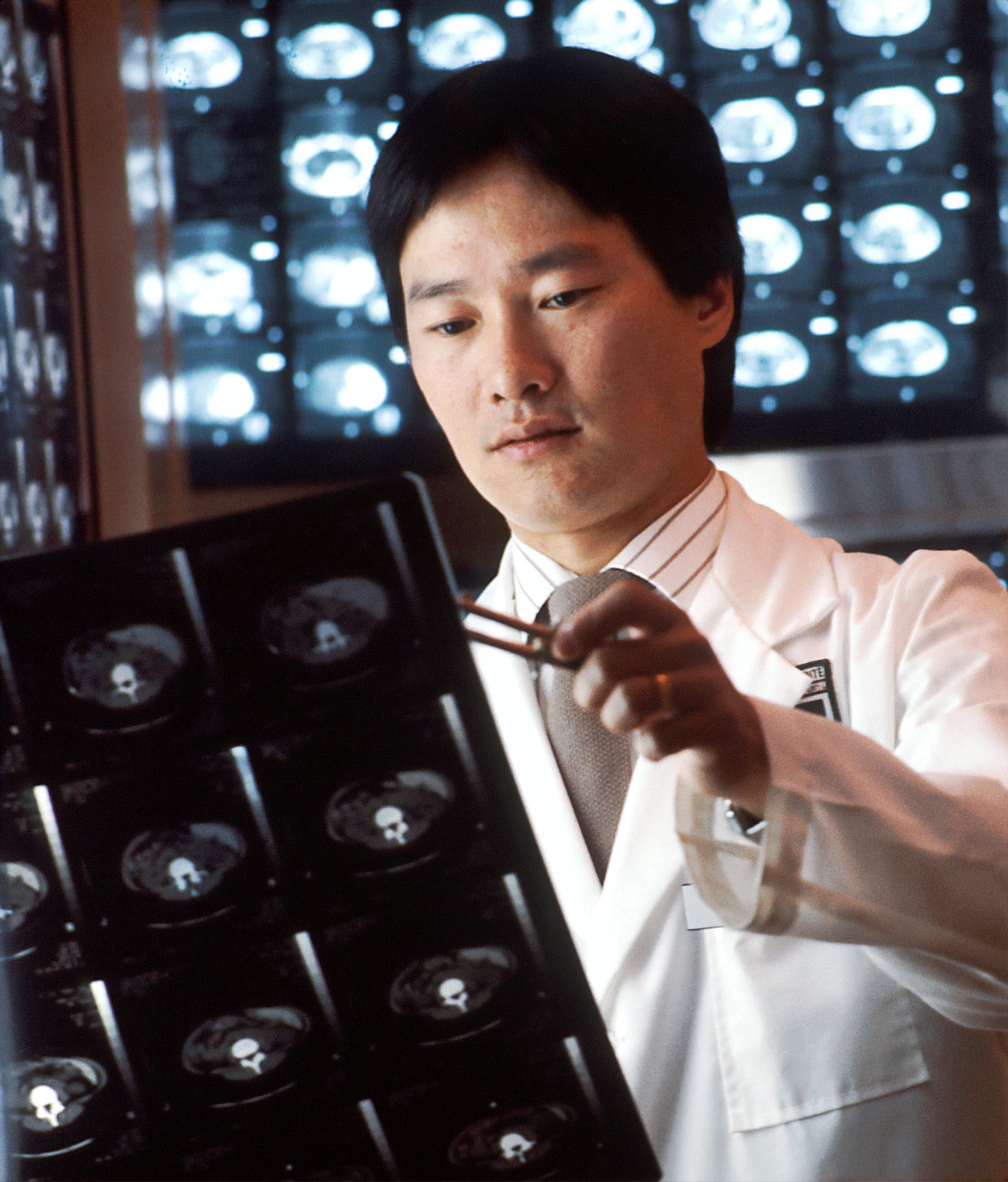 A doctor looks at a CT scan of the abdomen. Radiologists are more skeptical of whole-body MRI for screening.
