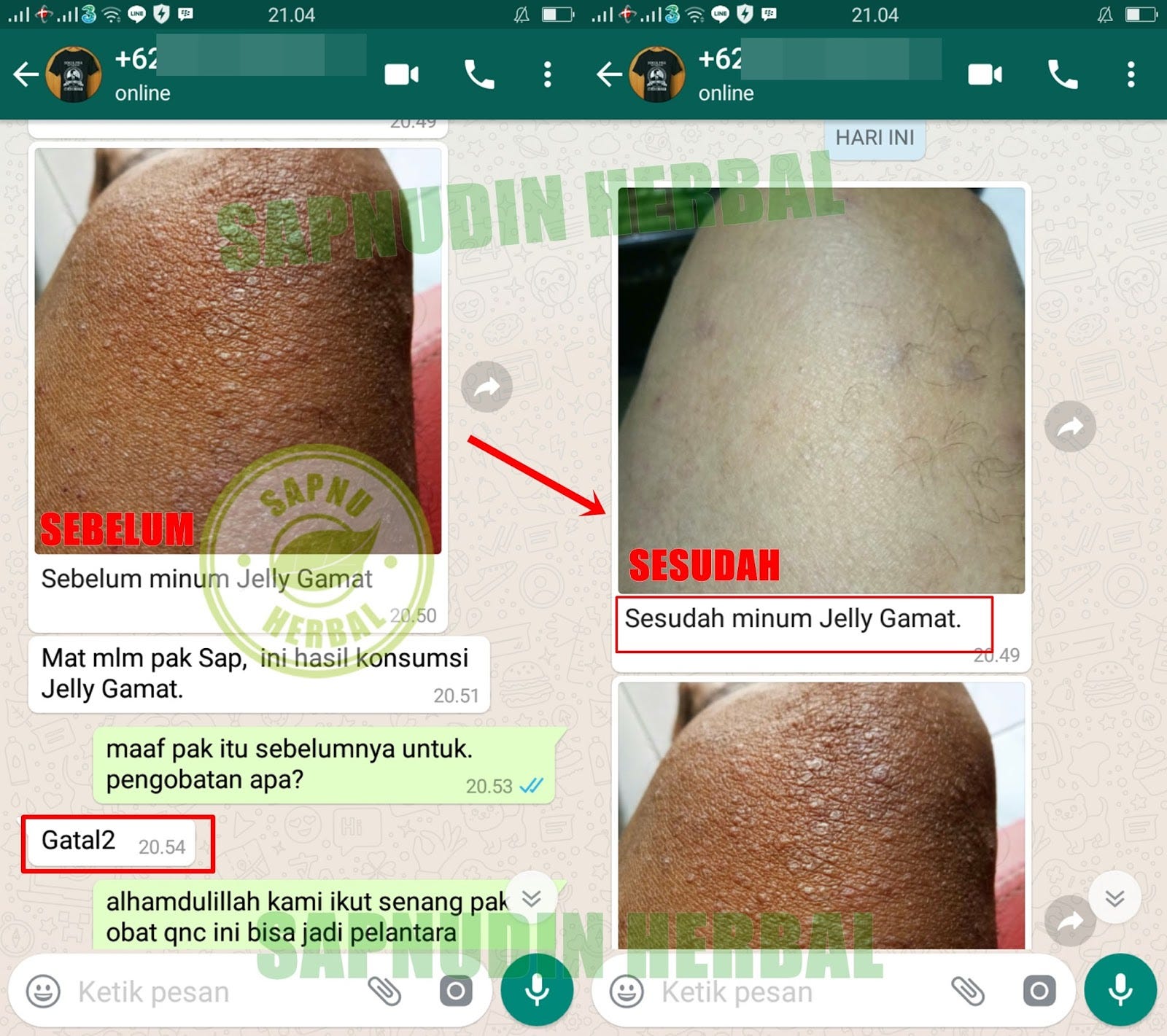 Dan berikut kami lampirkan beberapa Testimoni bukti nyata kesaksian dari mereka yang menggunakan QnC Jelly Gamat sebagai perantara kesembuhannya