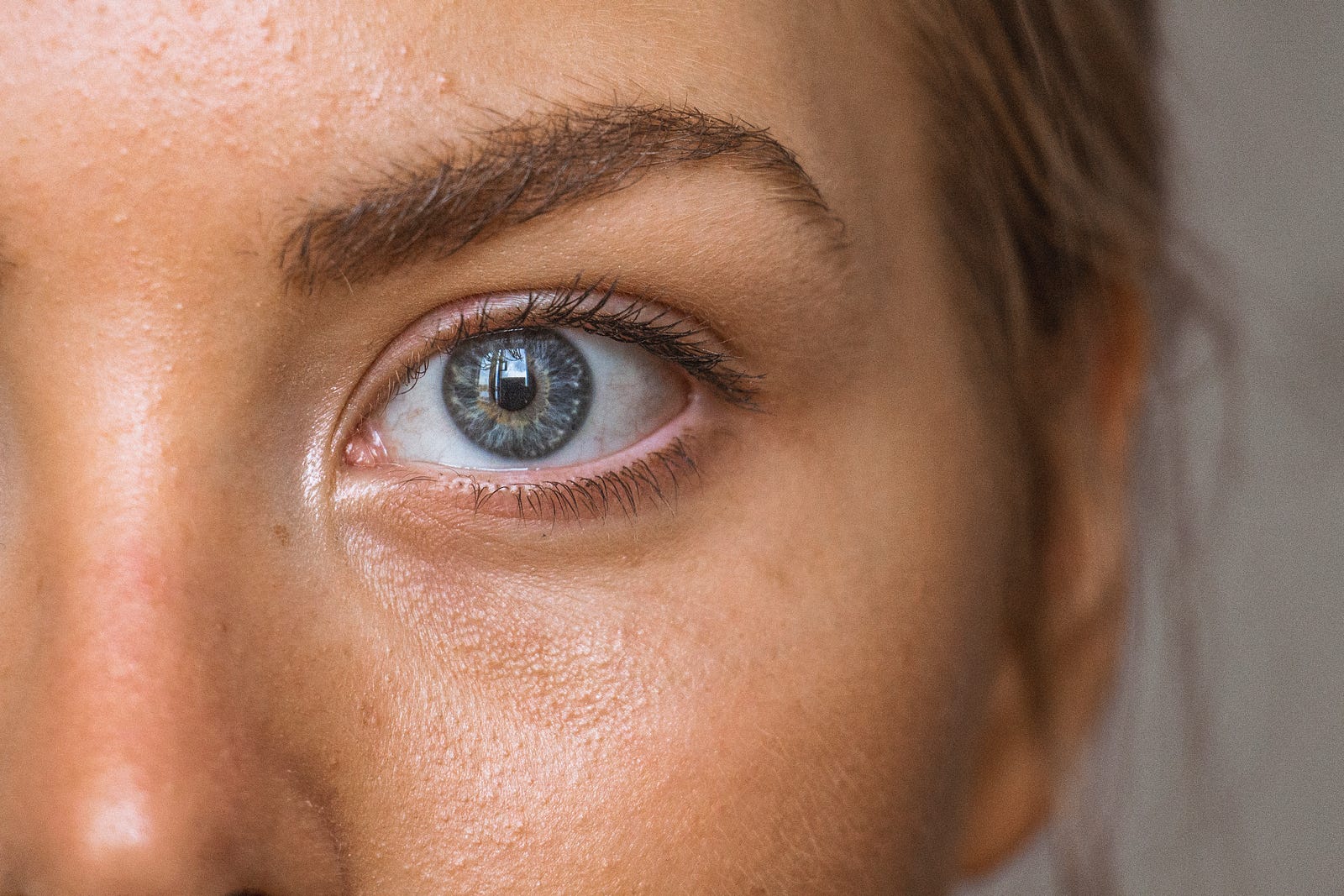 A white woman, with blue eyes, gazes at us with her left yey. We see only the upper left part of her face. The positive effects of traditional Botox injections are temporary, typically lasting for a few months before requiring repeat treatments.