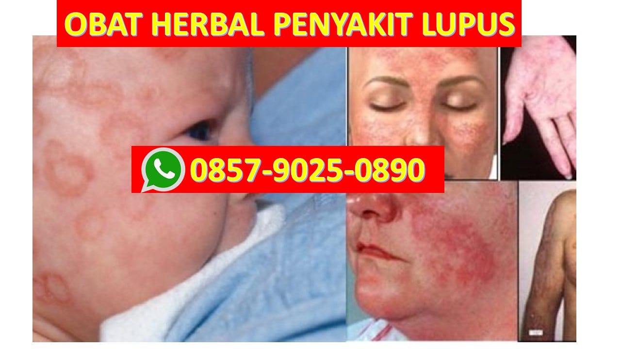 Solusi Tepat No Wa 62 857 9025 0890 Pengobatan Alternatif