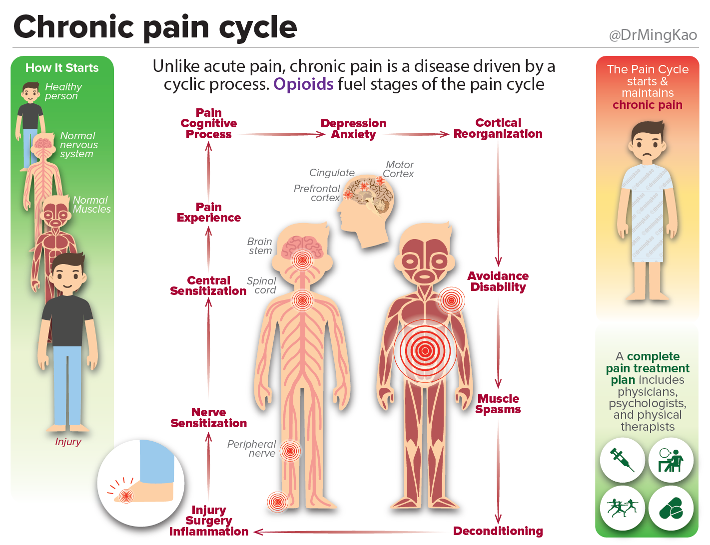 Chronic pain cycle – Within Normal Limits of Reason – Medium