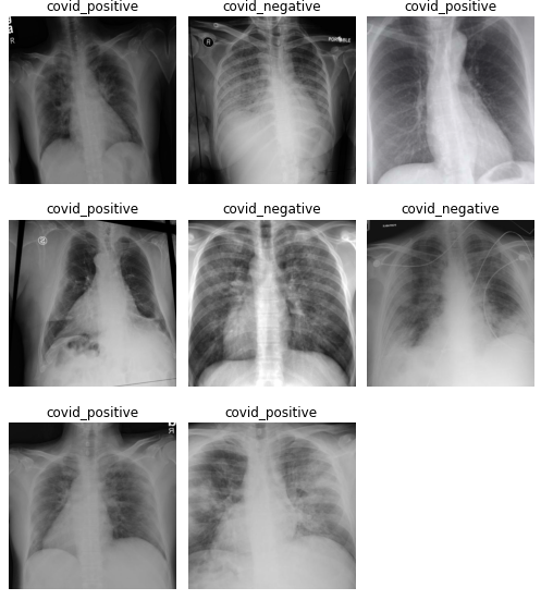 Using X-Ray Images to detect COVID-19 Patients