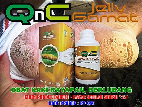 Nama Obat Salep Kaki Rayapan Parah Anti Jamur Yang Berlubang