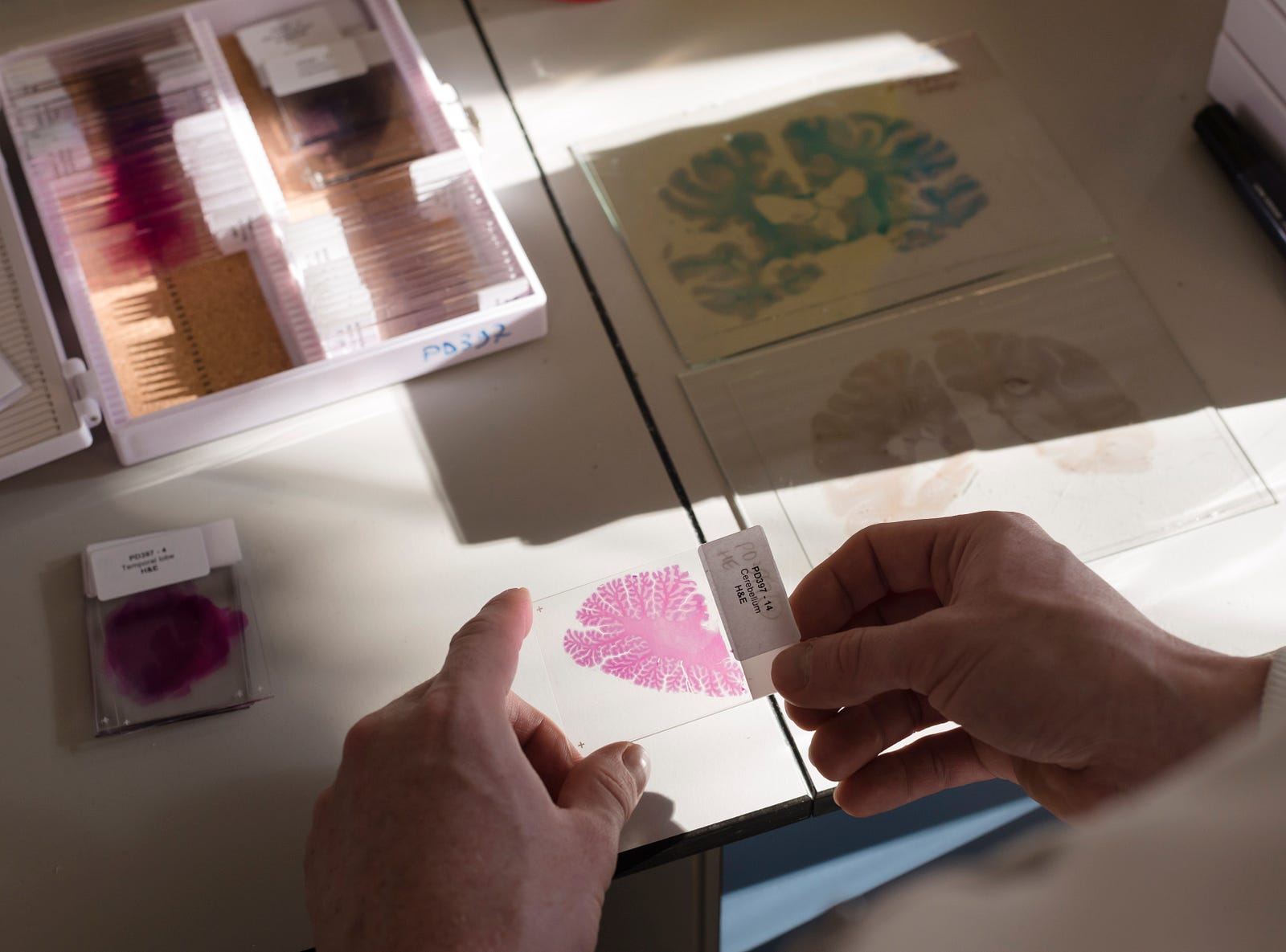 Early Brain Changes May Help Predict >> What Brain Areas Are Affected By Parkinson S Parkinson S Uk Medium Early Brain Changes May Help Predict >> What Brain Areas Are Affected By Parkinson S Parkinson S Uk Medium