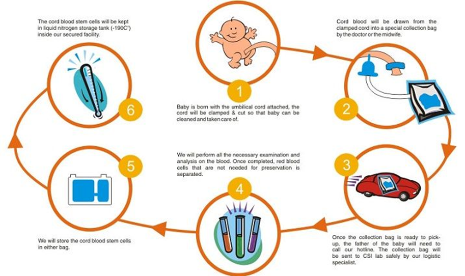 Umbilical cord stem cell treatment