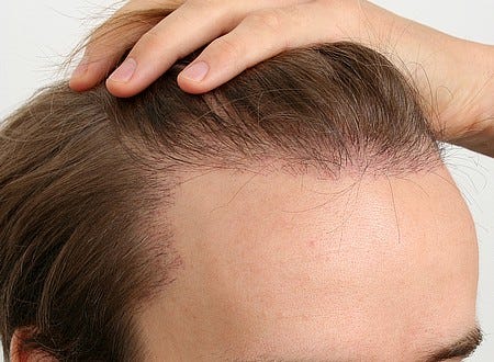 1-2-3 be a pornstar Mature hairline or balding